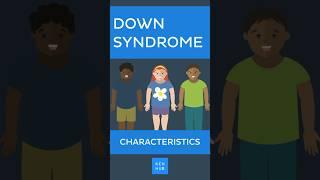 Down Syndrome: Characteristics #downsyndrome