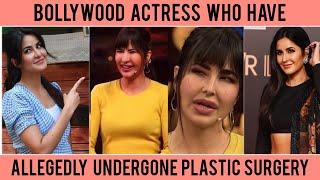 15 Bollywood Actresses’ Plastic Surgery: Before And After Pictures