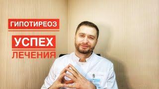 Гипотиреоз. Диагностика и успех лечения субклинического гипотиреоза