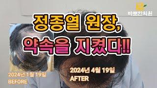 #바로한의원 #정종열 원장 #탈모치료 약속을 지켰다!! - B.G. 바로시스터즈 의 난다송