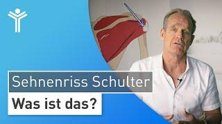 Sehnenriss an der Schulter: Warum Sie Ihre Schulterschmerzen rechtzeitig behandeln lassen sollten