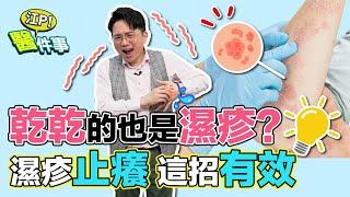 濕疹癢到不行 3招止癢超有效！ 濕疹 也會是乾乾的？ 千萬不要用熱水！【 江P醫件事 156】 江坤俊醫師