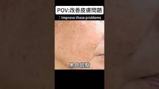 改善皮膚角質受損、黑斑、皺紋細紋 #皮膚 #保養 #skin  #粉刺 #痘痘 #皮膚保養 #肌膚管理 #skincare #保養品  #skincareroutine #臉部保養