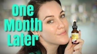 MAD HIPPIE VITAMIN C SERUM...ONE MONTH LATER!