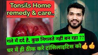 टॉन्सिलाइटिस घरेलू उपचार | Tonsillitis Home Remedies and care