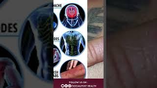 Incubation period Explanation By Dr Jagadeesh  || Socialpost Health | #shorts
