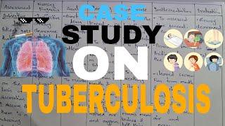 Case study on Tuberculosis/ Case presentation on Tuberculosis. | Medical Education.