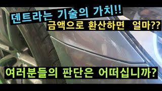 덴트복원 기술의 가치는