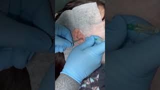 #DoubleTragus #Piercing by Jabba done in #GetPierced #CarlisleCumbria #UKPiercing #UKPiercer