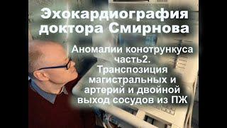 28.Аномалии конотрункуса часть2. Транспозиция магистральных и артерий и двойной выход сосудов из ПЖ