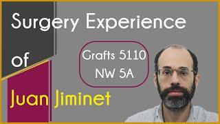 Juan Jiminet shares his hair transplantation surgery experience at Eugenix India by Dr. Arika Bansal