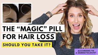 Is This Hair Loss Treatment Right for You? | Dr. Sam Ellis