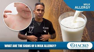 What Are the Signs of a Milk Allergy? [Chacko Allergy]