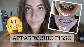 APPARECCHIO FISSO | Aggiornamento dopo sei mesi