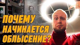 МИНОКСИДИЛ ЗЛО! Почему ты лысеешь? | Причины выпадения волос у мужчин.Опасность приёма миноксидила