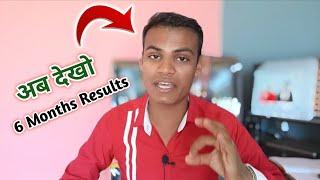Hair Transplant 6 Months Result Rekhram Sahu | Hair Transplant Raipur & Hair Transplant Bhopal City