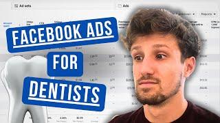 How To Run Facebook Ads (For Dentists) (5 Principles for Success)