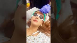 Facial laser hair removal treatment @MRAestheticsclinic | MR Aesthetics Lahore Best Skin Care Clinic