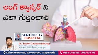 Signs of Lung Cancer | How to detect Lung Cancer at early stage | Sentini Hospitals #sentinihospital