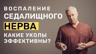 Воспаление седалищного нерва | Какие уколы при воспалении седалищного нерва наиболее эффективные