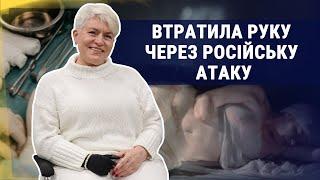 Життя після ампутації. Як херсонка відновлюється після обстрілу РФ?