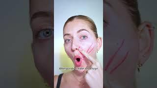 Nasolabial Folds Tutorial | Face Fitness, Facial Fitness, Facial Yoga