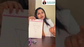 Endometriosis : All you need to know by Dr. Swati Rai