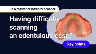 Mastering Intraloral Scanners - Edentulous scanning