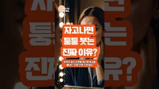 [건강코드] 자고나면 퉁퉁 붓는 진짜 이유?
