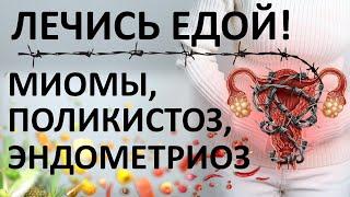 Эндометриоз, поликистоз и миома - не приговор! Излечись питанием!