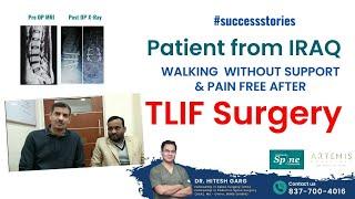 TLIF Surgery in India : Happy Patient from The Republic of Iraq  sharing his experience