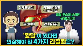 황달의 원인별 동반증상 4가지ㅣ원발성 담즙성 간경변(PBC)ㅣ원발성 경화성 담관염(PSC)ㅣ담도폐쇄ㅣ세균성 담관염