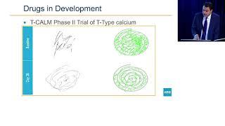 Essential Tremor: HSS