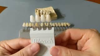 BL2 vs BL3 veneers color