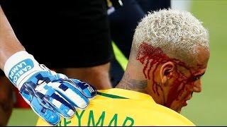 Le rompen la ceja a Neymar  You break the eyebrow Neymar 2017