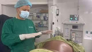 360° Liposuction | Abdomen liposuction | Back Liposuction | Body fat reduction | Dr Iqbal Ahmed