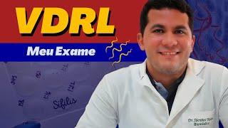 VDRL │ TESTE DE TRIAGEM PARA SÍFILIS │ MEU EXAME