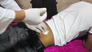 Intramuscular injection injection video #doctor  #injection