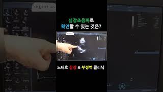 노태호의심장이야기