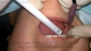 How To hold/Use The Highspeed Suction- Assisting Tips For The Hygienist