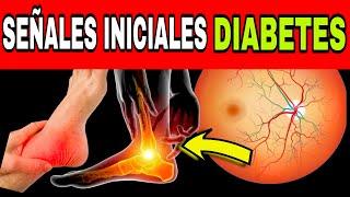 14 SEÑALES PELIGROSOS de DIABETES (azúcar alto en sangre)