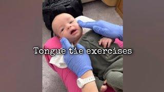 Tongue tie oral motor and body exercises for young baby