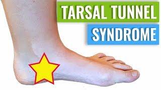 Tarsal Tunnel Syndrome Treatment & Diagnosis