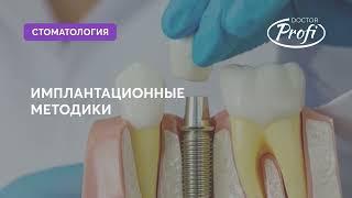 Методики имплантации зубов ( всё-на-4, всё-на-6 )