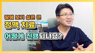 손등부터 팔까지 튀어나온 정맥의 치료범위