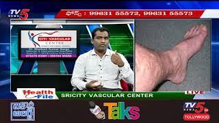 Varicose Veins: Symptoms, Causes & Treatment in Woman  with Dr Shailesh kumar Garge