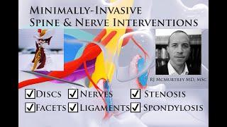 Minimally-Invasive Treatments for Cervical & Lumbar Spine Disc, Nerve, Facet, Stenosis, Spondylosis