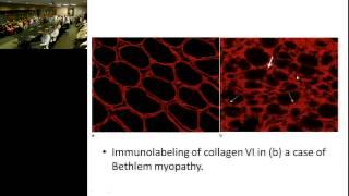 UAMS Neurology Grand Rounds 080814