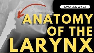 Larynx Anatomy | Radiology anatomy part 1 prep | CT interpretation