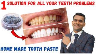 Just 1 Solution for All Your Teeth problems| Remove Plague and Whiten Your Teeth At Home